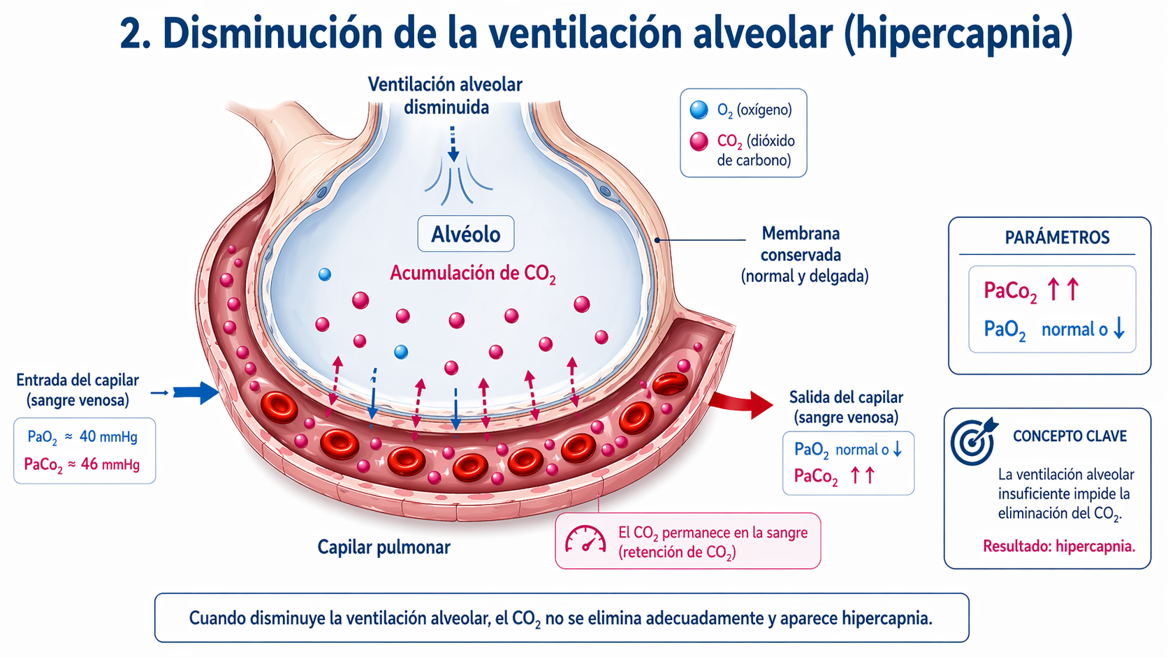 Disminución de ventilación alveolar